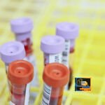 In Tem Mã Vạch Y Tế Chuẩn Bệnh Viện – Kháng Hóa Chất, Giá Xưởng -